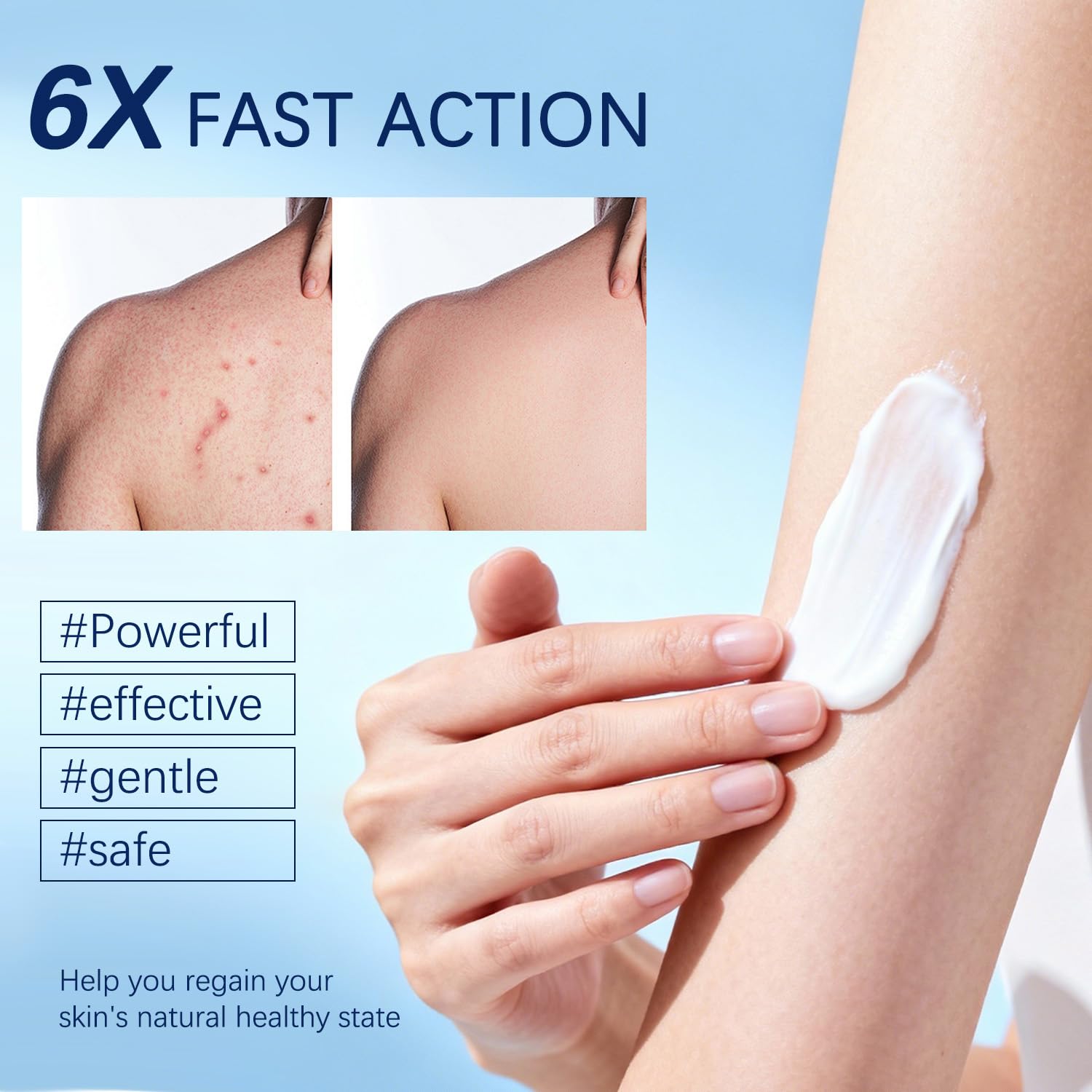 OUHENGTEK Folliculitis Cream after-cleansing scalp scene for soothing daily care.