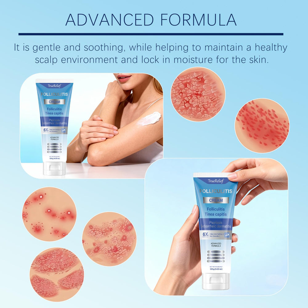 OUHENGTEK Folliculitis Cream two-pack box signals uninterrupted routine.