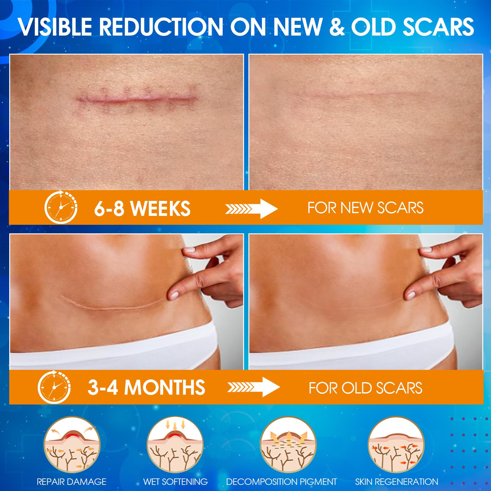 OUJEALEE cut-to-size scar tape being trimmed to fit exact scar area.