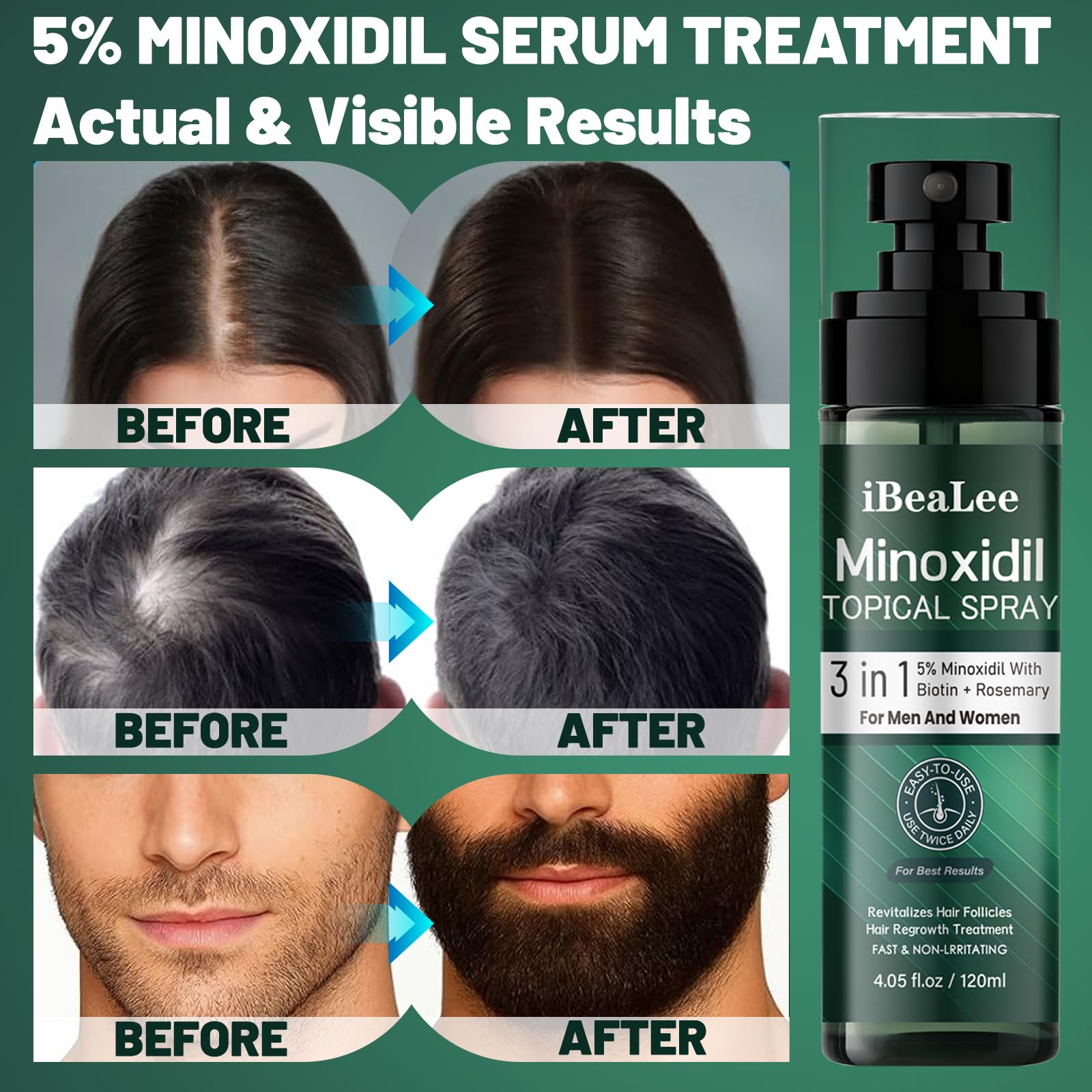 OURMUST beard minoxidil regrowth application for thicker facial hair