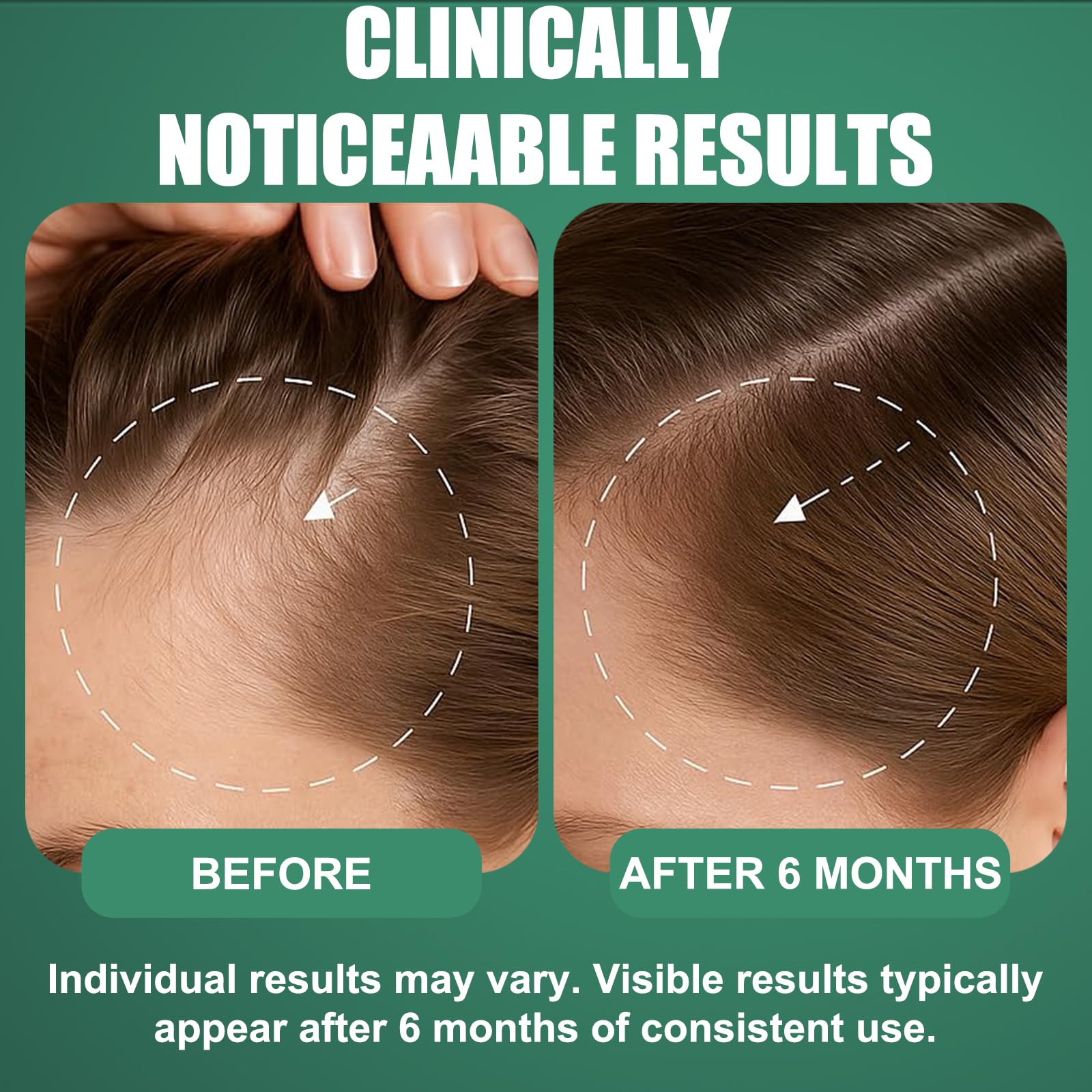 OURMUST biotin rosemary formula label highlighting 3-in-1 benefits