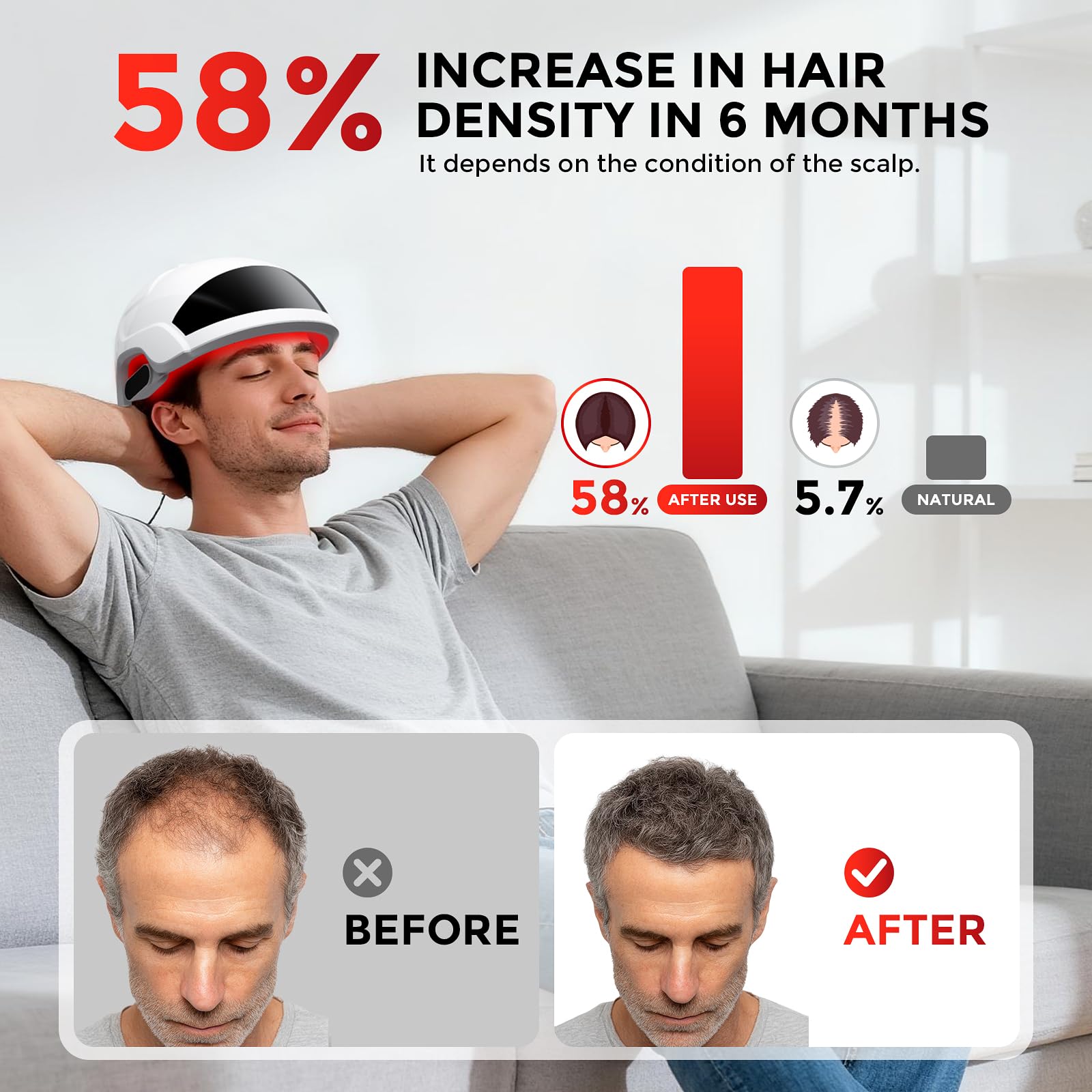 OVEKPA FDA-cleared laser cap worn on head for safe at-home treatment