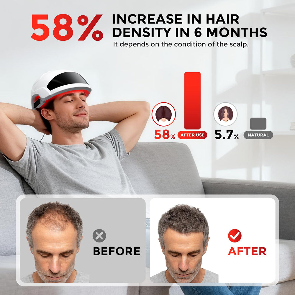 OVEKPA FDA-cleared laser cap worn on head for safe at-home treatment