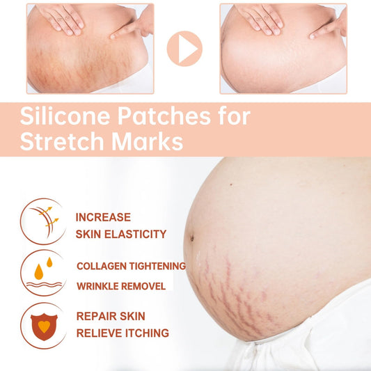 OWILIWO stretch-marks patch on belly area showing discreet wear