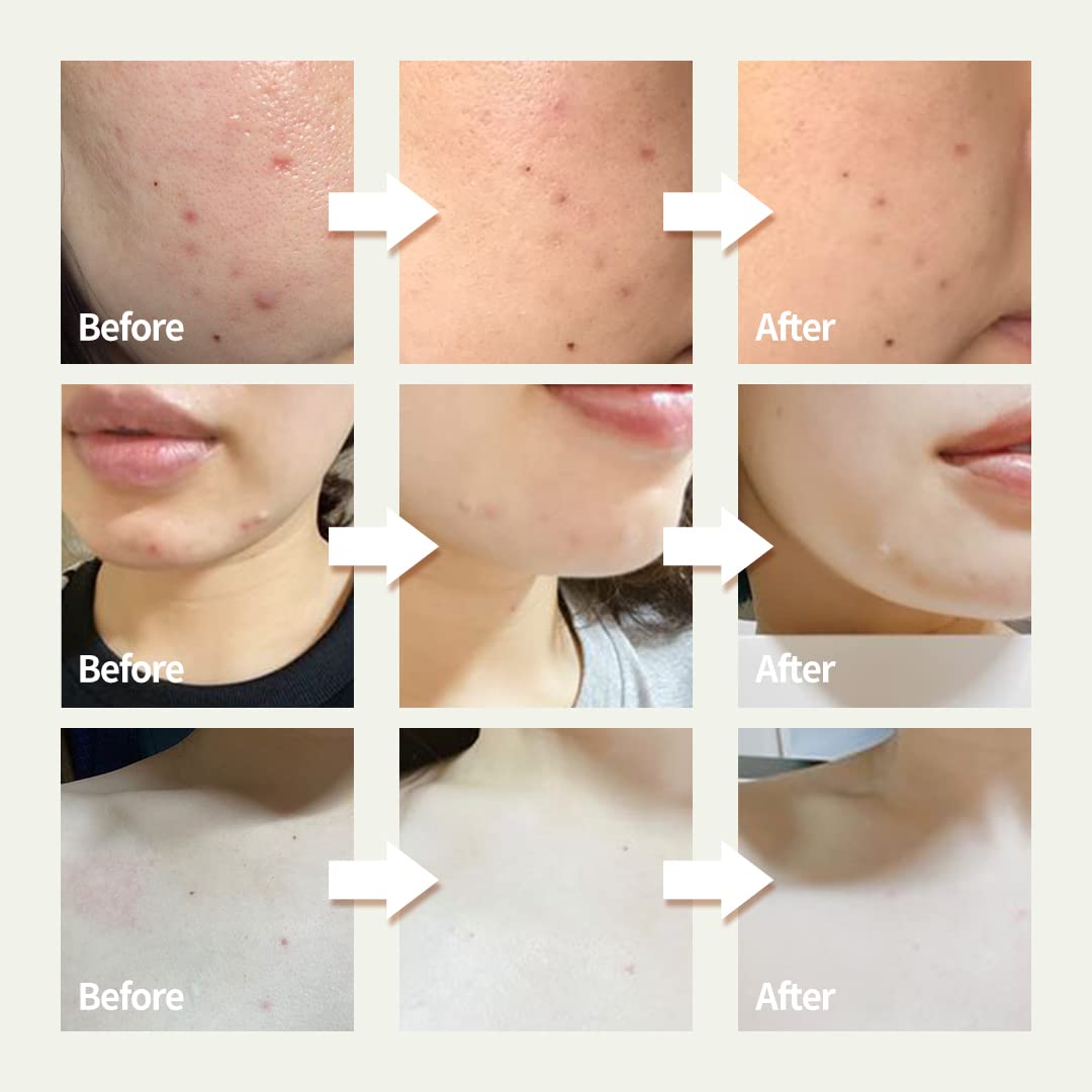 OxygenCeuticals Creamy-texture application demonstrates smooth, even spreading.