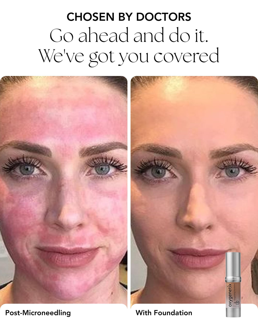 Oxygenetix Coco foundation swatch on skin demonstrates natural finish.