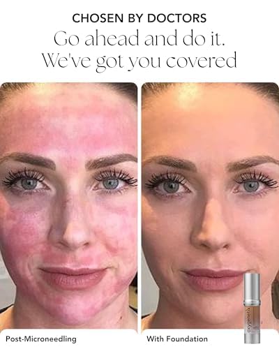 Oxygenetix Oxygenating Foundation Porcelain blend on face highlights seamless skin tone match.