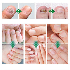 PARWENE Nail Care all-nail-types portrait suggests universal compatibility