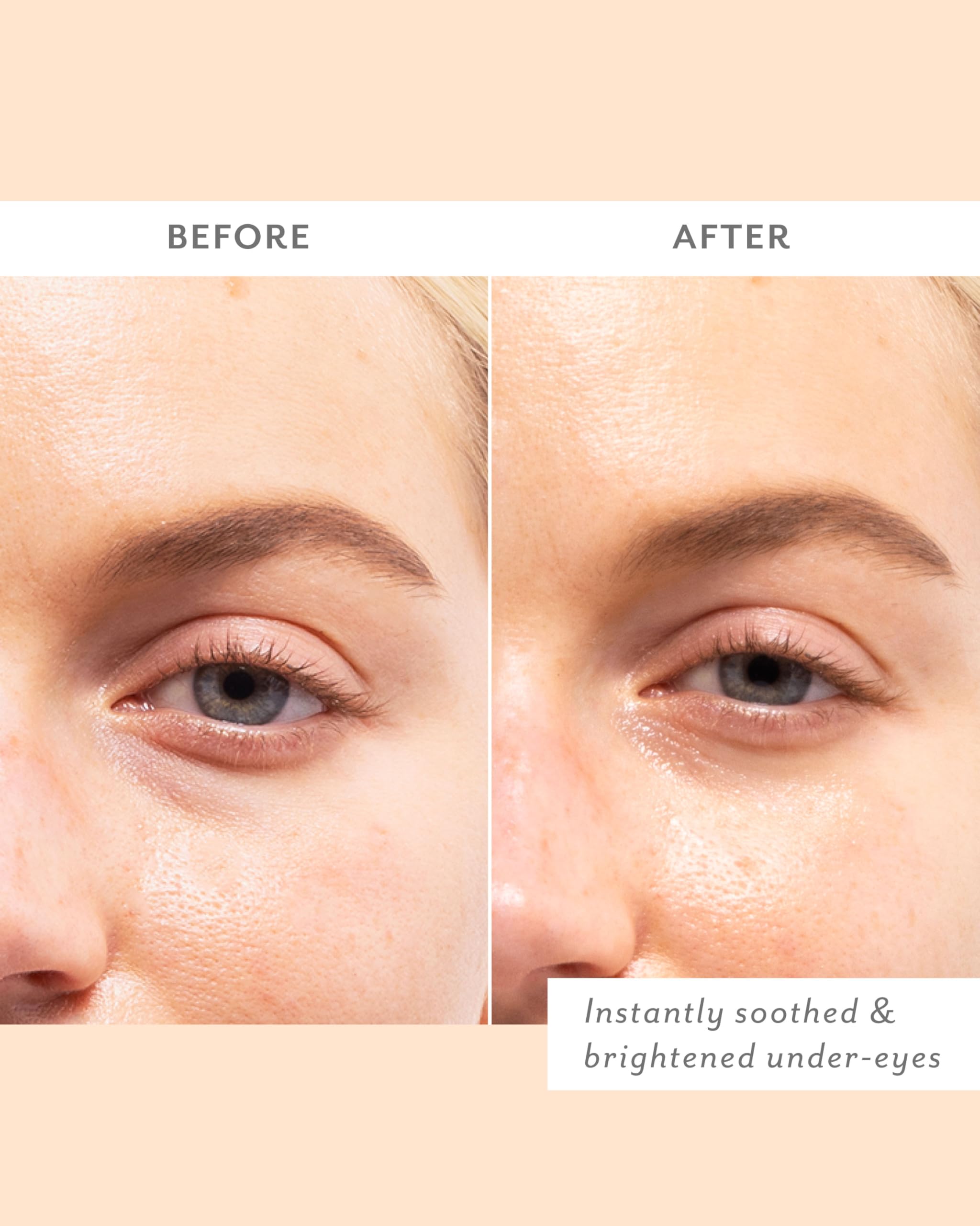 Patchology Cozy Comforts ceramides and probiotics support moisture.