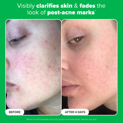 Fragrance-free Paula's Choice Boost label on product packaging