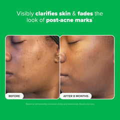 Oil-free Paula's Choice Boost serum texture ready for daytime use