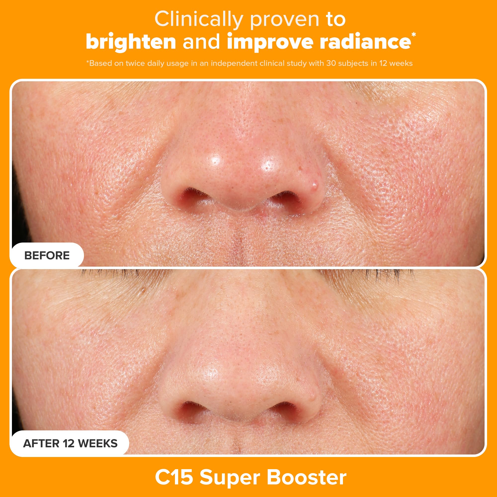 Paula's Choice C15 Booster Serum; vitamin C for even tone and subtle glow.