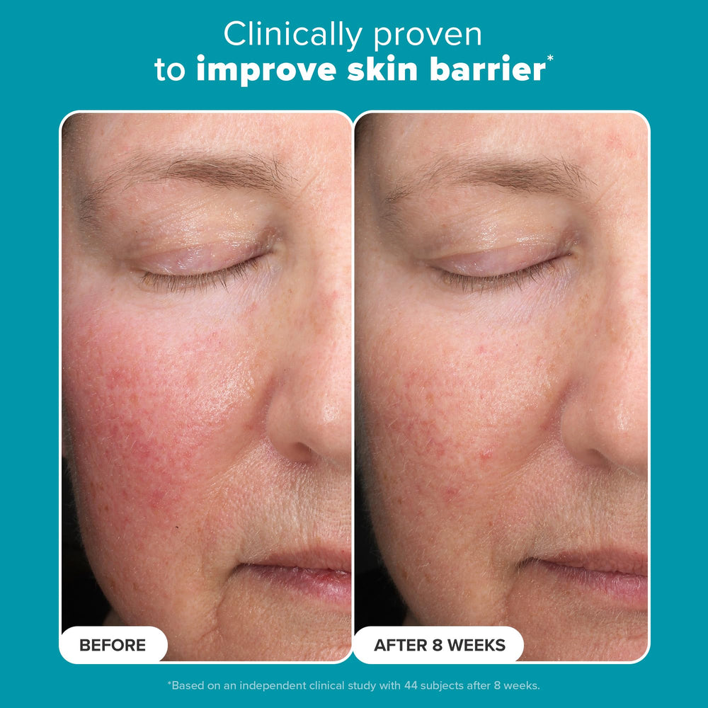 Paula's Choice glowing skin close-up suggesting improved radiance with consistent use