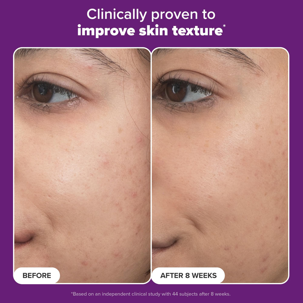 Radiant skin glow after applying Paula's Choice serum.