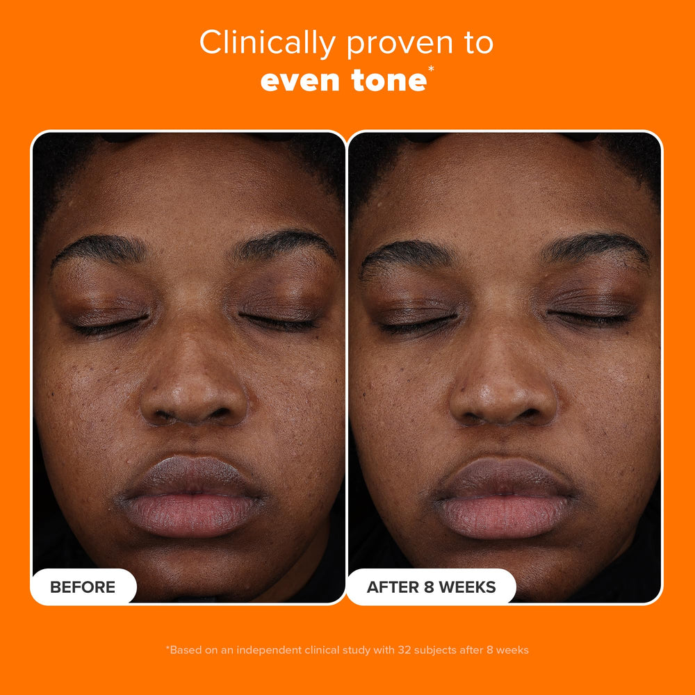 Serum in hand from Paula's Choice for easy daily use