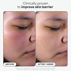 Paula's Choice Skin Perfecting 2% BHA Pads close-up pores focus for refined texture.