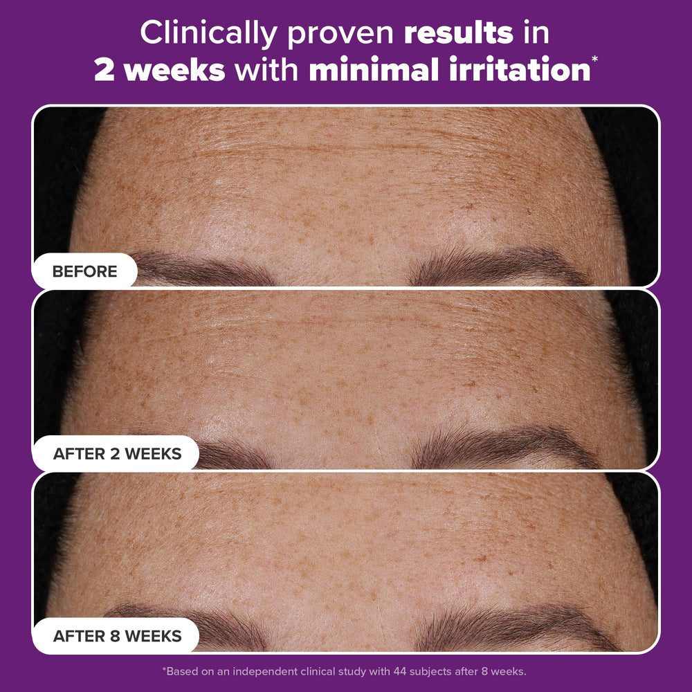 Close-up of refined skin texture after using Paula's Choice serum.