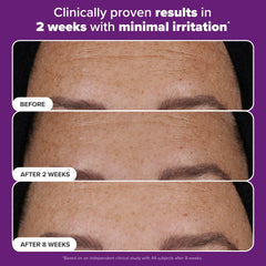 Close-up of refined skin texture after using Paula's Choice serum.