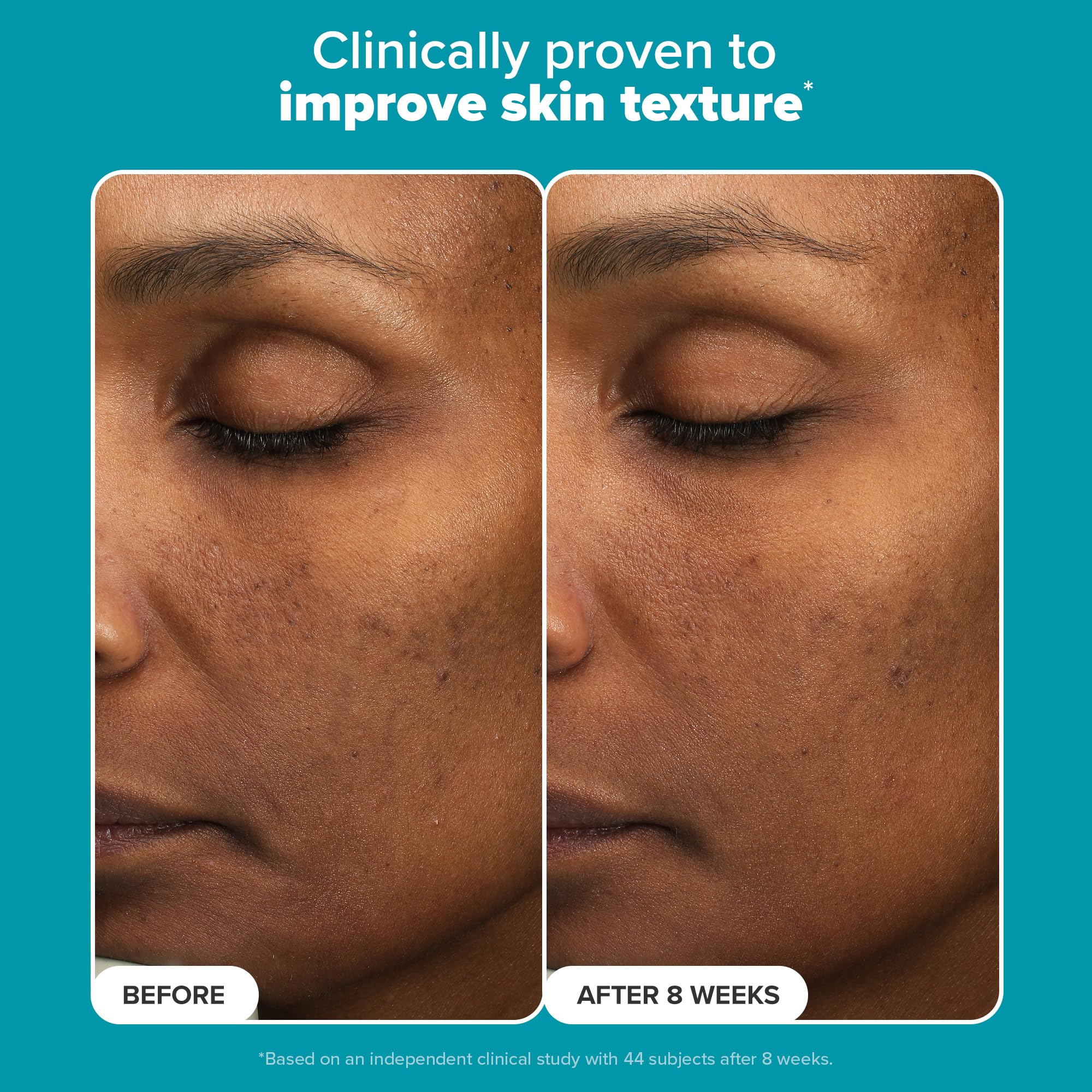 Paula's Choice time-released lactic acid demonstrates steady exfoliation