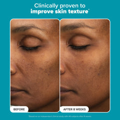 Paula's Choice time-released lactic acid demonstrates steady exfoliation