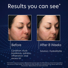 Jar displays matte finish after application on oily skin