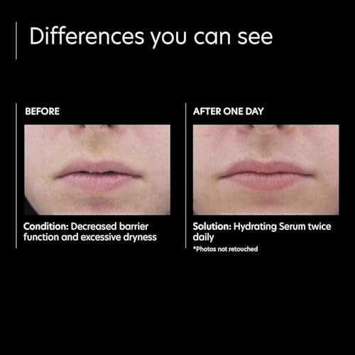 Silky, lightweight PCA SKIN Hydrating Serum formula suitable for daily use on dry skin.