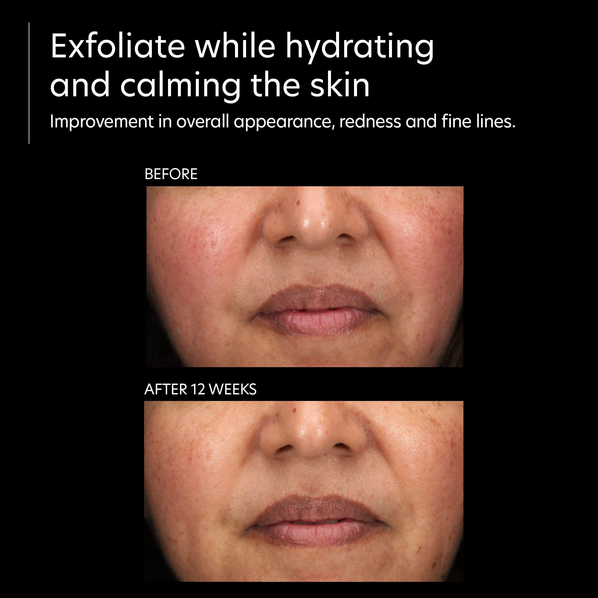 PCA SKIN Resurfacing Serum packaging signals trusted at-home care.