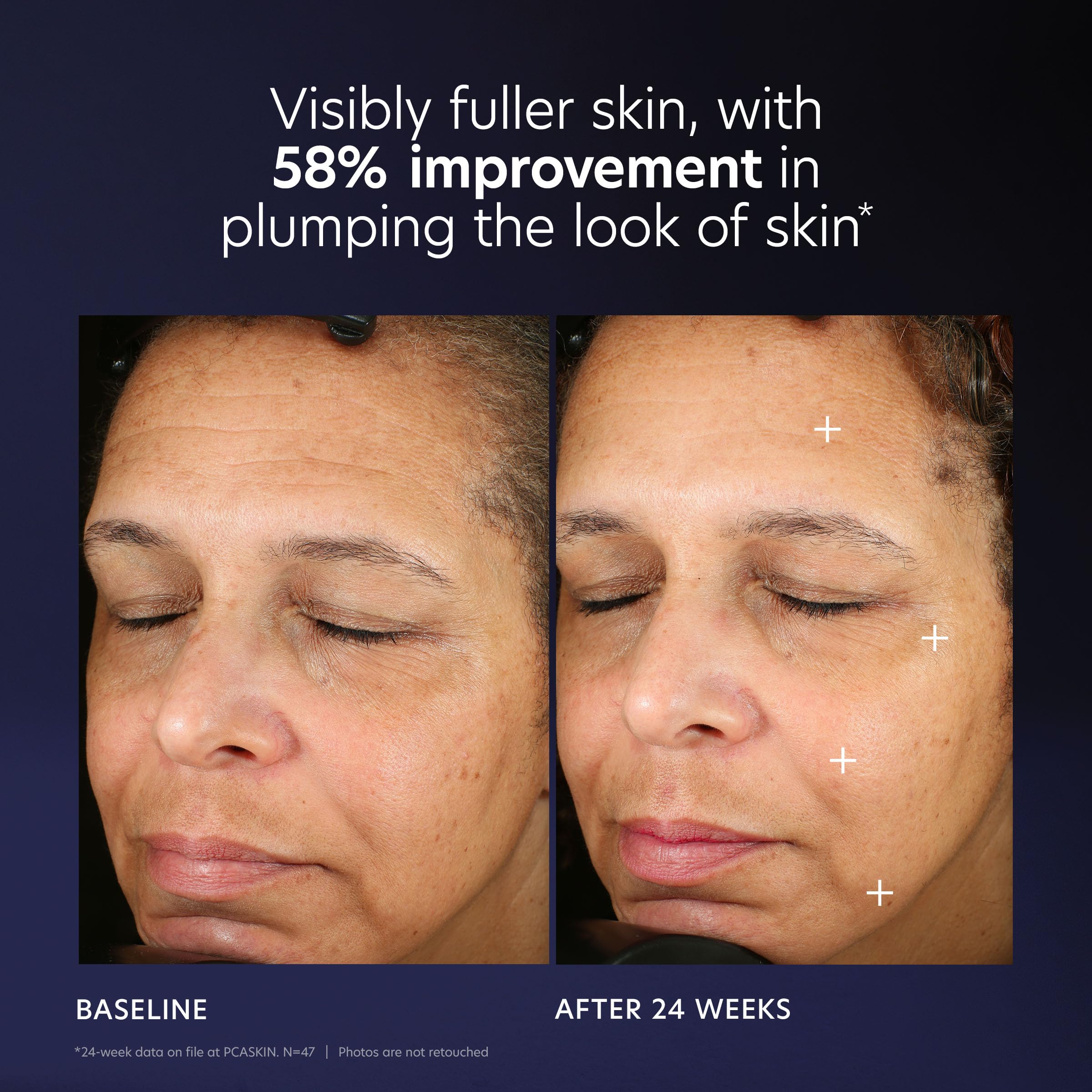 PCA SKIN Pro Max Age Renewal routine-ready setup for morning skincare.