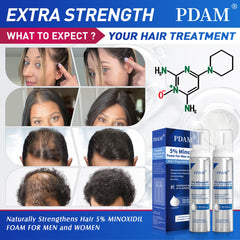 Pdam Minoxidil foam dispensing tip for easy application