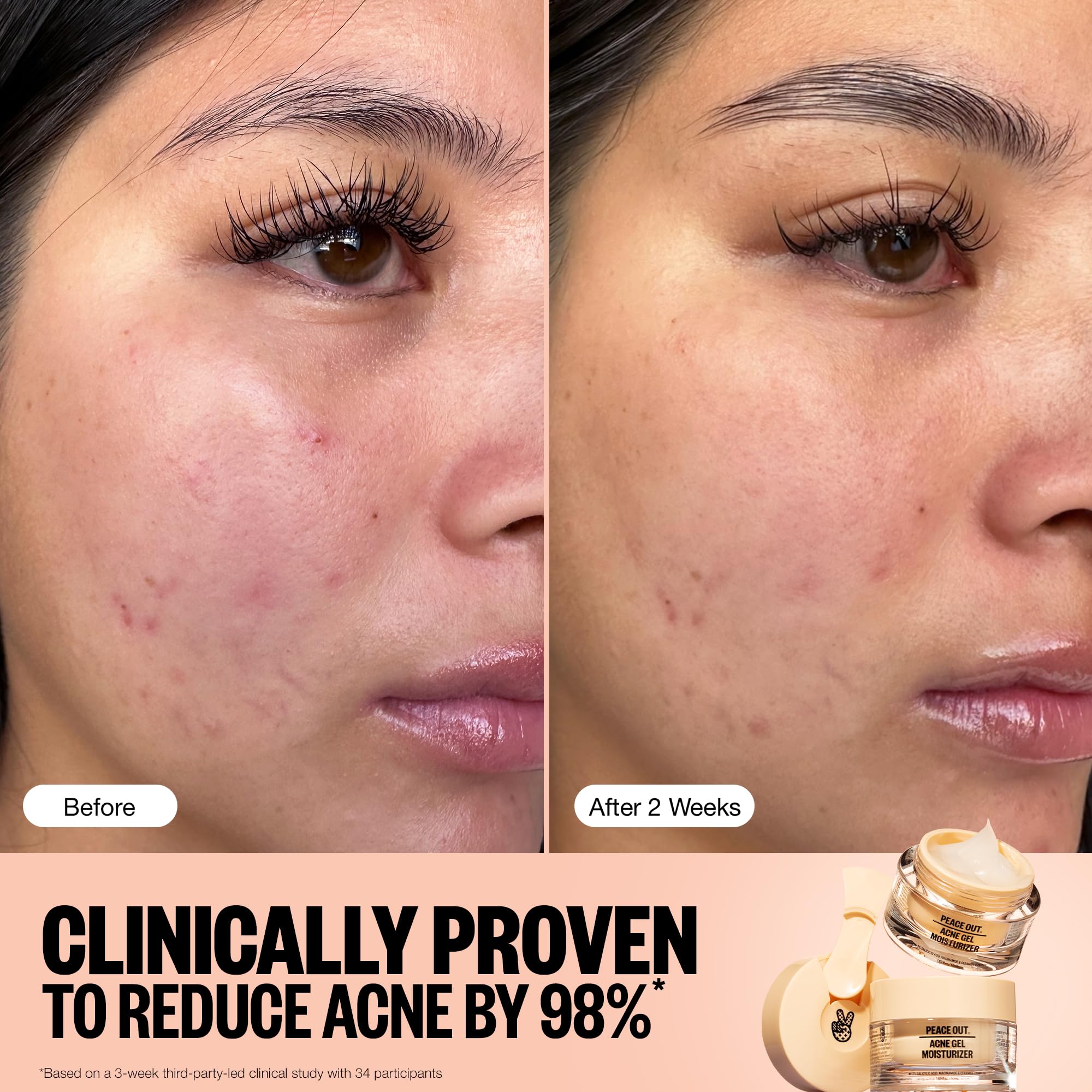 PEACE OUT Acne Gel Moisturizer packaging displays clean design for everyday use