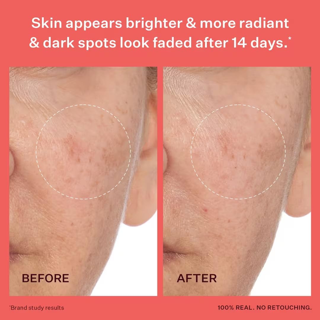 Peach & Lily Transparen-C Pro Brightening Moisturizer swirl highlights even tone potential.