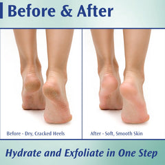 Pedifix 20 percent urea foot smoothing cream jar revitalizes rough skin.