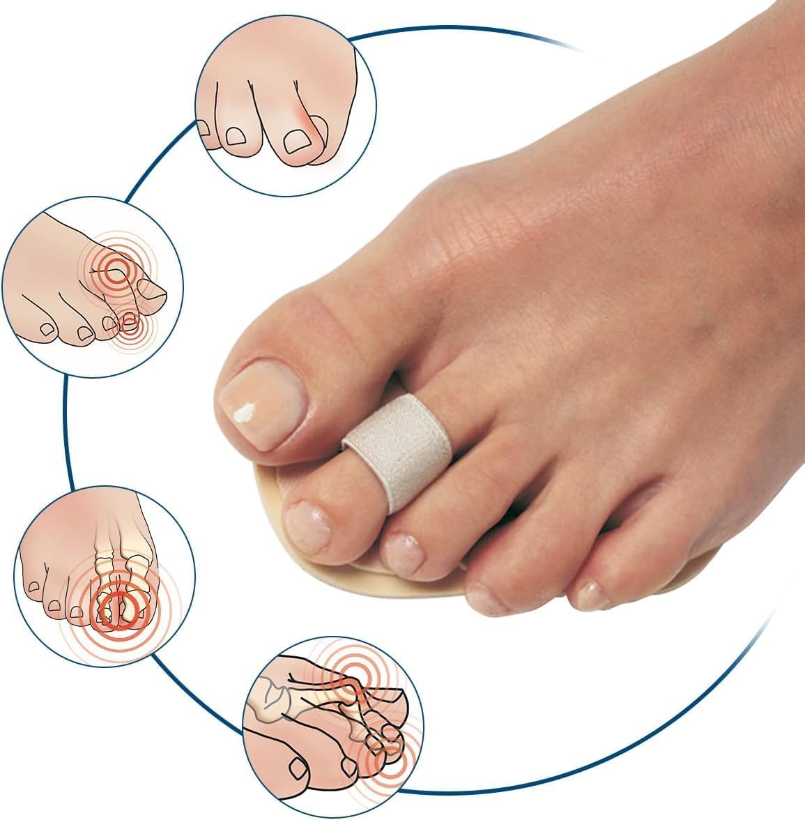 Pedifix bulk pack 12 toe straighteners for value and convenience