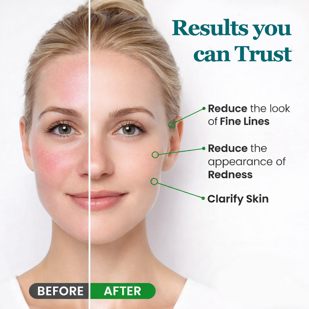 Peehss eyes and cheeks with rose quartz roller for rejuvenation