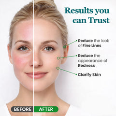 Peehss eyes and cheeks with rose quartz roller for rejuvenation