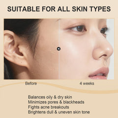 Applying Peel Shot Glow Rice Ampoule Duo delivers a soft hydration boost.
