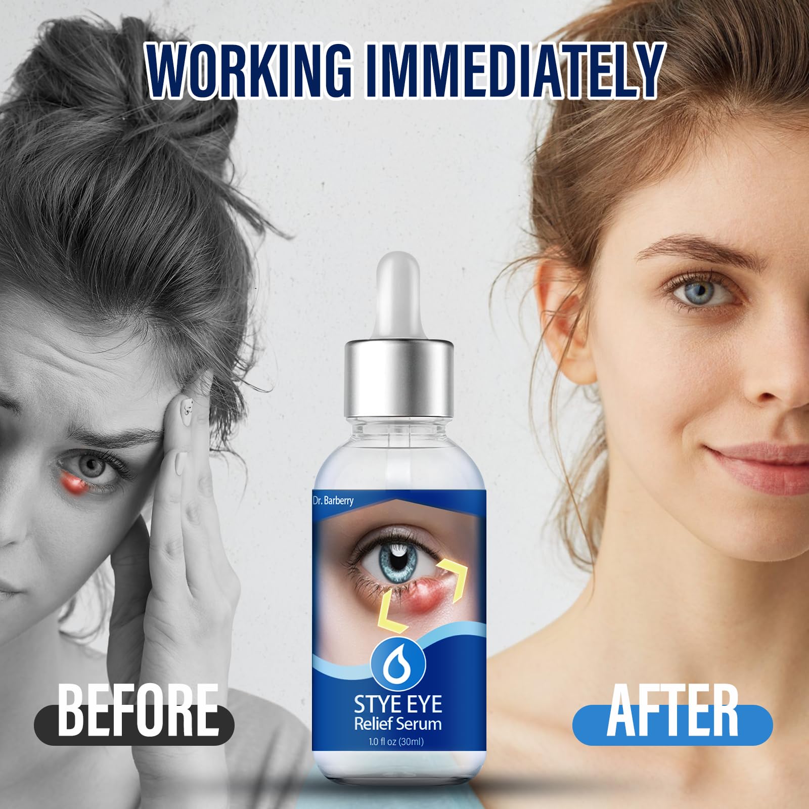 Penntr Stye Eye Drops application closeup illustrating two-drops technique
