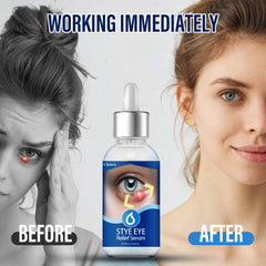 Penntr Stye Eye Drops application closeup illustrating two-drops technique