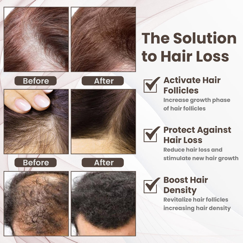 Calming scalp care setup with PeptideLabz routine.