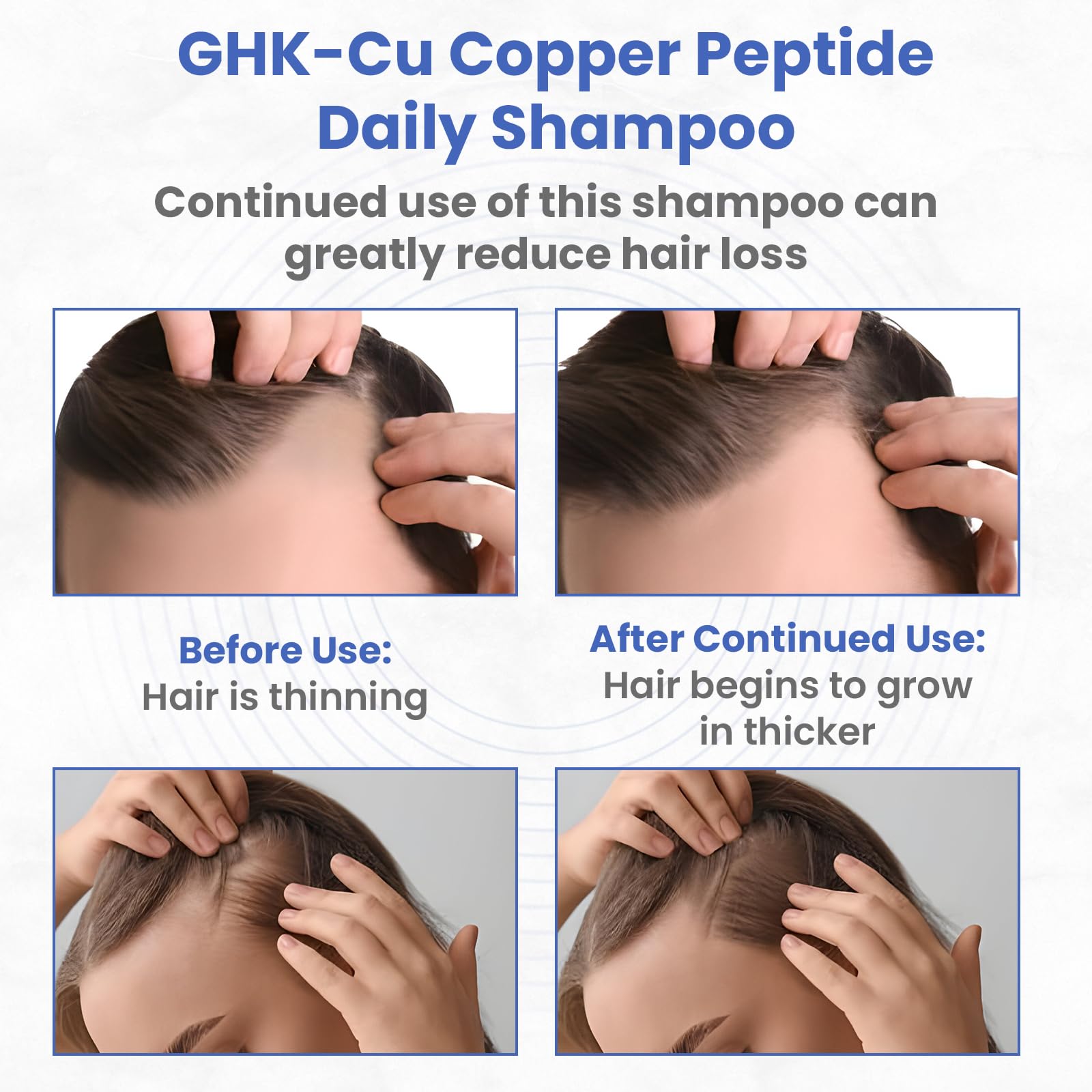 PeptideLabz Copper Peptide Shampoo foamy lather on hand, ready for daily nourishing wash.