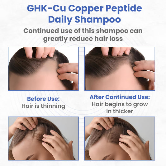 PeptideLabz Copper Peptide Shampoo foamy lather on hand, ready for daily nourishing wash.
