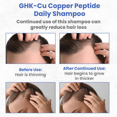 PeptideLabz Copper Peptide Shampoo foamy lather on hand, ready for daily nourishing wash.