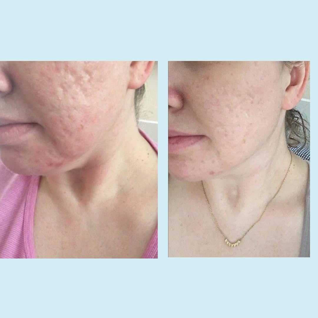 Ingredients show green tea extract and retinol for nourishment.