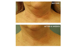 Perricone MD peptide blend supporting neck skin firmness