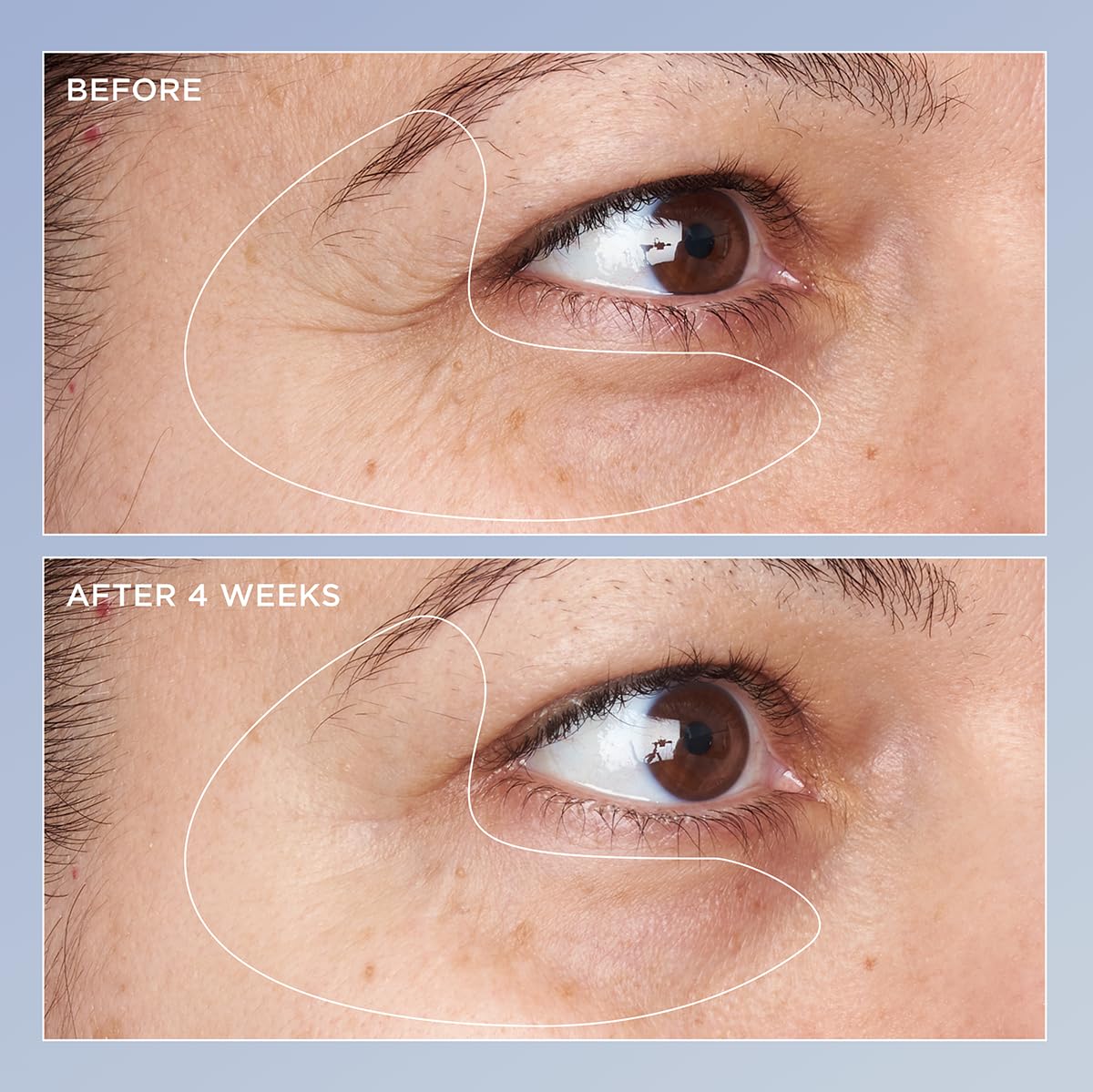 Perricone MD Triple Retinol Eye Serum creamy texture for smoother under-eye appearance.