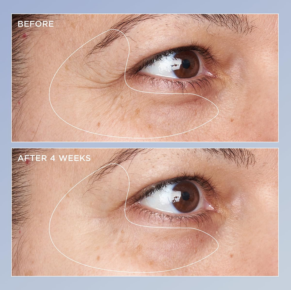 Perricone MD Triple Retinol Eye Serum creamy texture for smoother under-eye appearance.