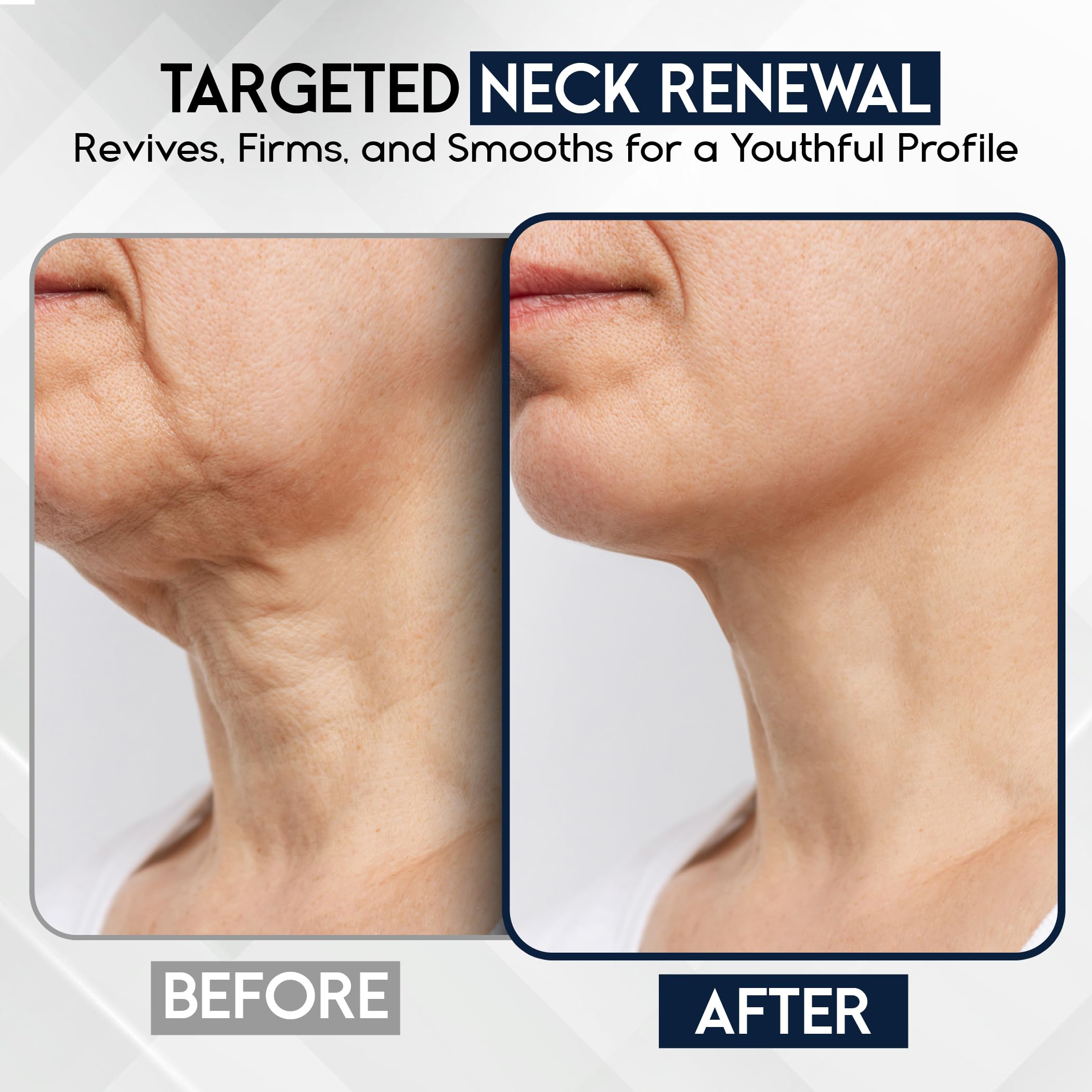 Pharmlitalia face tightening lift defines the jawline and neckline