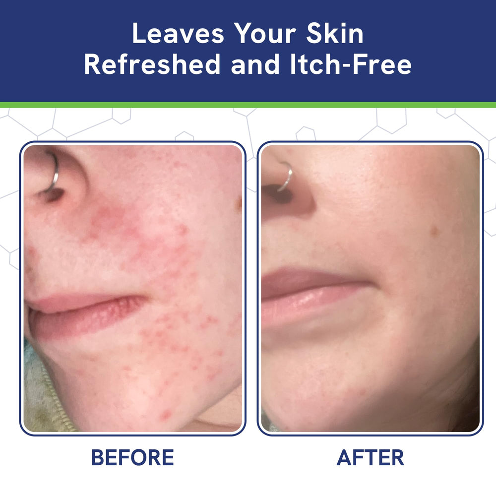 pHat 5.5 Manuka honey balances your skin pH.