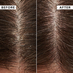 Philip Kingsley Flaky Scalp Shampoo scalp closeup demonstrates soothing action.
