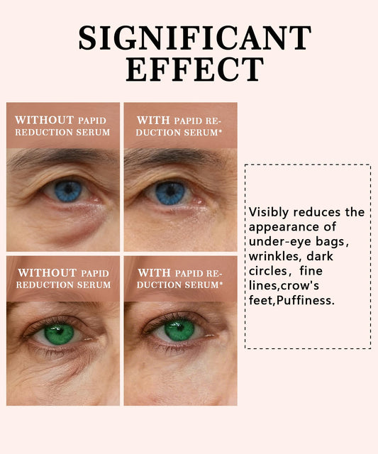 Phydrulis perfection firming lift cream being applied for refreshed eyes